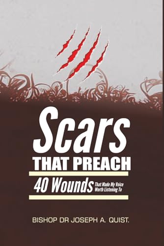 SCARS THAT PREACH: 40 Wounds That Made My Voice Worth Listening To (The Legacy and Leadership Series: A Prophet�fs Journey Throug