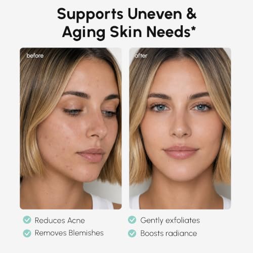 Image of MAREE Azelaic Acid Acne Clearing Pads - Exfoliating Pads with Glycolic & Hyaluronic Acid for Face - 10% Azalecic Acid & Centella Redness Soothing Pad - Zero Pore Facial Toner Pad - Acido Azelaico