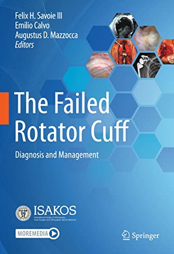 The Failed Rotator Cuff: Diagnosis and Management (English Edition)
