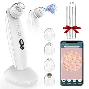 VITCOCO Comedondrukker Vacuüm, Black Dot Aspirator 6 niveaus Zuigkracht Porie Vacuüm Gezichtsvlekverwijderaar met 5,0…