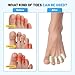 GOKOZIKI 40PCS Premium Foam Toe Separators & Toe Cushions, Soft Foam Toe Spacers for Overlapping Toes, Individual Toe Separators, Between Toes Cushion Pads for Women and Men, Toe Dividers, Foot Care
