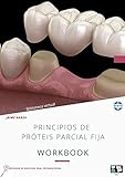  Principios de prótesis parcial fija : Workbook