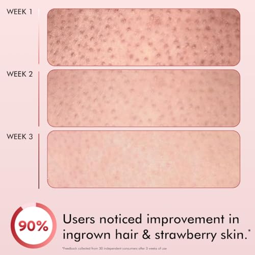 Image of mCaffeine 11% AHA BHA Strawberry Body Lotion for Skin Smoothening | Gently Exfoliates Dead, Dry, Even Tones Skin | 72hr Moisturization | Juicy Strawberry Scent, For Men & Women-200ml