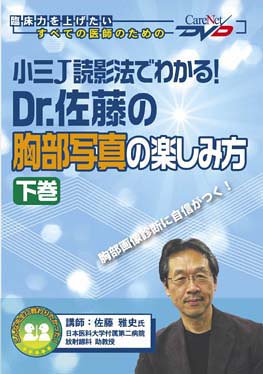 楽天 無料電子書籍 小三J読影法でわかる! Dr.佐藤の胸部写真の楽しみ方 (下巻) ケアネット バイ