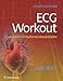 ECG Workout: Exercises in Arrhythmia Interpretation