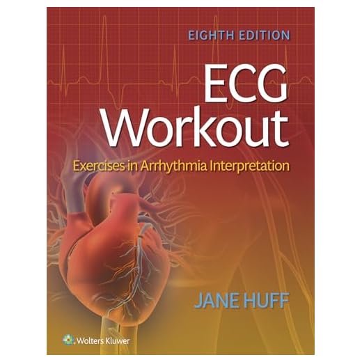 ECG Workout: Exercises in Arrhythmia Interpretation