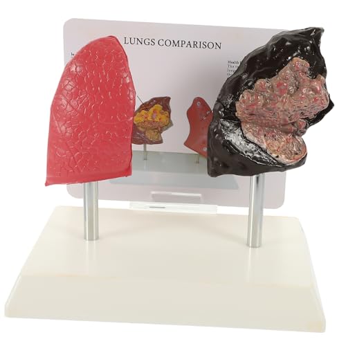 NAMOARLY 1 PC Lung Structure Lung Model for Teaching Lung Trust Drops Teaching Respiratory Lung Model 1: 1 Lung Model Smoking Lung Model Anatomy Model Vivid Respiratory Lung Model Pvc