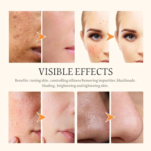 Turmeric Clay Mask,Turmeric Vitamin c Face Mask,Clay Face Mask,Turmeric Mask Stick,Clay Mask for Pores Deep Cleanse,Reduce Acne Dark Spots & Pores Anti-Aging,Brightening for Men and Women - Image 6