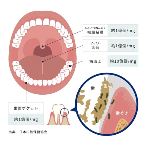 歯科医推奨 モンダミン ハビットプロ 1080ml HABITPRO 洗口液 マウスウォッシュ 子供 ノンアルコール 天然ミント アース製薬株式会社 医薬部外品 薬用 洗口液 X-9N 歯肉炎予防 出血予防 歯垢付着予防 口臭予防 口中浄化・爽快 (1本)