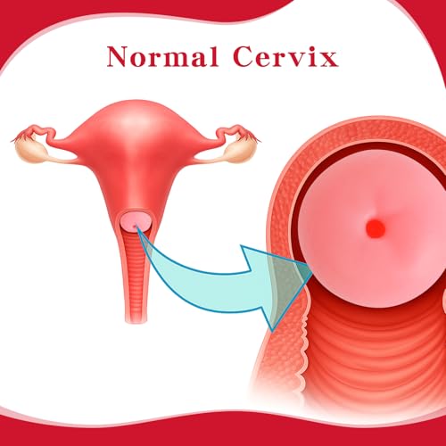Image of SimCoach Cervix Replicas Model, 6 Cervical Pathology Models for OB /GYN Training & Patient Education, Gynecological Teaching Tool