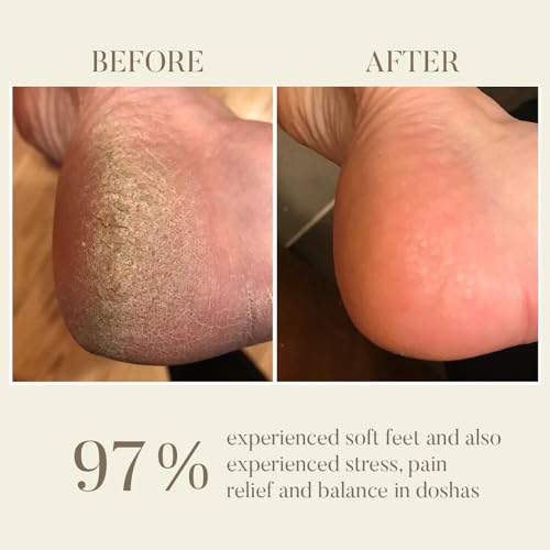 Image of Ohria Ayurveda Kansa Foot Massage Wand | Traditional Ayurvedic Foot Massager with Teakwood Handle & Kansa Cap for Deep Relaxation| Premium Kansya Wand| Soothes Tired Feet| For blood circulation & Stress Relief - 1 Piece
