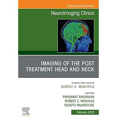Imaging of the Post Treatment Head and Neck, An Issue of Neuroimaging Clinics of North America, E-Book