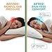 SleepEasy [USA Made] Cotton Comfort CNH Pillow with Ear Hole for Side Sleepers, Pressure and Pain Relief, Ergonomic, Breathable, and Hypoallergenic with Soft Revoloft Fill, Made in The USA