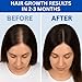 Copper Peptide Hair Serum – 10% GHK-Cu + 5% AHK-Cu Peptides for Hair Growth & Scalp Health – Advanced Regrowth Treatment for Thicker, Fuller Hair