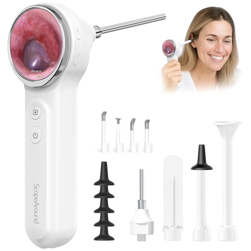 ScopeAround Otoscope, 1080P FHD Ear Scope Set, Digital Otoscope w/1.85in IPS Screen, Ear Wax Removal Tool Camera, Video Otoscope Ear Camera with 6 LED Lights, Compatible with Android/iPhone