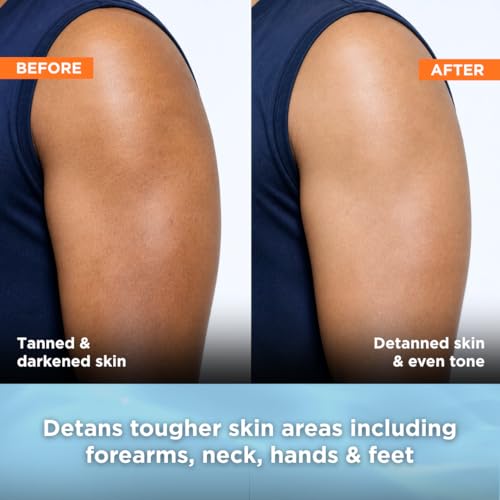 Image of Clarity Labs | DETAN BRIGHTENING SOAP | (Pack of 4) | Tan Removal | KOJIC ACID SOAP | Niacinamide | Vitamin C Kojic | Dark Spot Removal | Even Skin Tone | Glowing Brighter Skin | Reduces underarm pigmentation