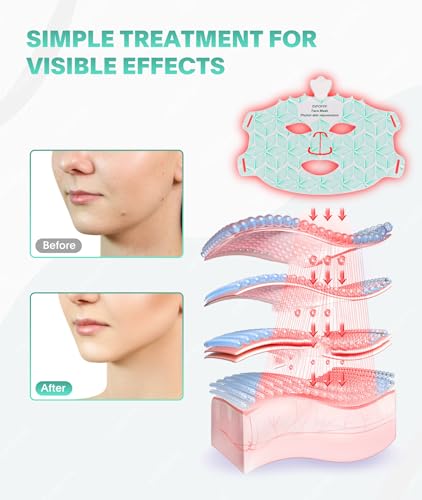 Evfofo A-025 Red Light Therapy Mask thumb #4
