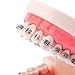 Easyinsmile Dental Orthodontic Teeth Model with Metal Bracket Tooth Model with Braces for Patients Communication