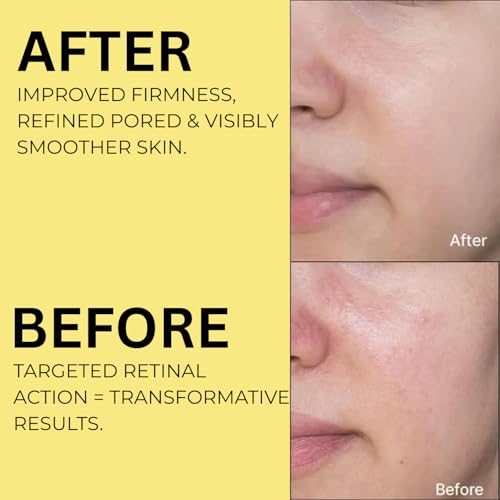 Image of Vita-A Retinal Shot Tightening Booster with 0.1% Retinal, Matrixyl & Niacinamide | Pore Minimizer, Wrinkles & Fine Lines, Firmer Skin, Korean Face Serum (15ml)