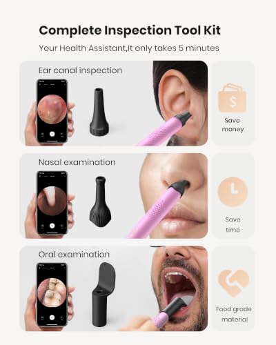 Image of BEBIRD R1 Wax Removal Tool for Ear - Spade Ear Canal Cleaner with Camera 1080P Earscope, Wax Remove Ear Picker with Vari Replacement Tips, Camera with 6LED Light, Pink