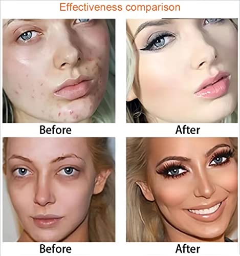 Yarlady 15 Colors Full Coverage Concealer Palette,Contouring Cream,Contouring Foundation Concealer Palette - Vegan, Animal Free And Hypoallergenic (Z-01) #TOP4