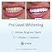 Snow Teeth Whitening Kit - Snow Teeth Whitening Serum and LED Mouthpiece Whitener, Formulated with Hydroxyapatite, Good for 6 Months - Wireless Kit with 3 Wands