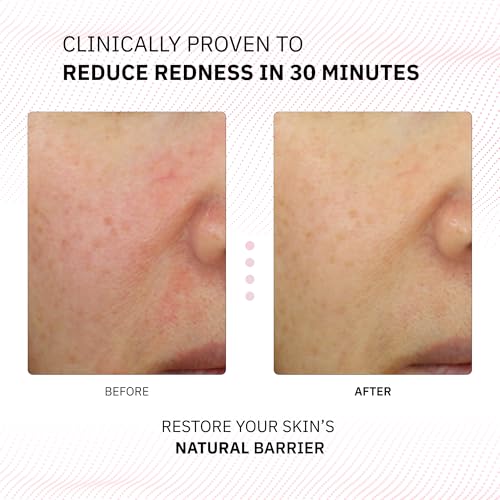 Physiogel 12230884 Calming Relief Facial Cream, Reduces Redness In 30 Mins thumb #1