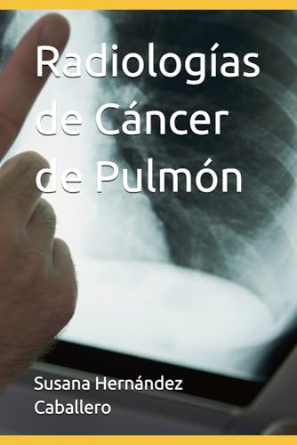 Radiologías de Cáncer de Pulmón (Spanish Edition)