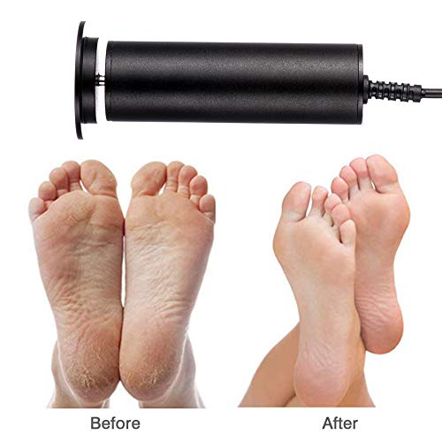 Electric Foot File With 60Pcs Replacement Sandpaper Disk, Professional Pedicure Foot File Sander For Men Women Dead Cracked Hard Dry Skin（Large） #TOP3