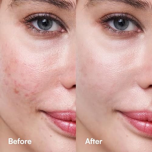 Celement C Berry Oil Serum with Vitamin C, Sea Buckthorn, Rosehip, Jojoba, Squalane - Reduces Hyperpigmentation, Age Spots, Scars, Fine Lines - Nail and Cuticle Treatment - Glowing Skin, 1 fl. oz