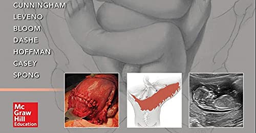 Williams Obstetrics, 25th Edition