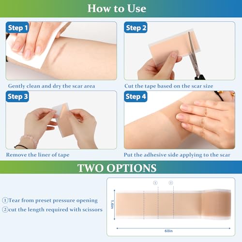 Candyhome BHT-1 Silicone Scar Sheets thumb #3