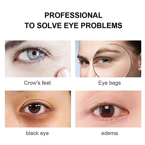 Magic Eye Cream, Instantly Remove Under Eye Bags Wrinkles Puffiness Dark Circles And Fine Lines, Anti Aging Eye Cream #TOP1