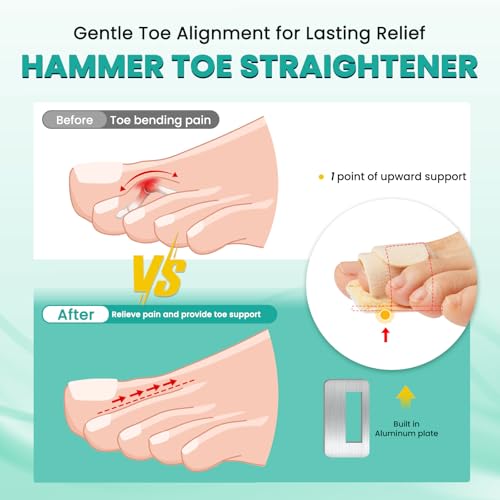 TASZOOS 2pcs Hammer Toe Straightener Corrector for Women & Men - Adjustable Hammer Toe Straightener with Aluminum Plate, (Beige) Toe Splints Wraps - Realign Bent, Curled, Crooked, Claw, Hammer Toes