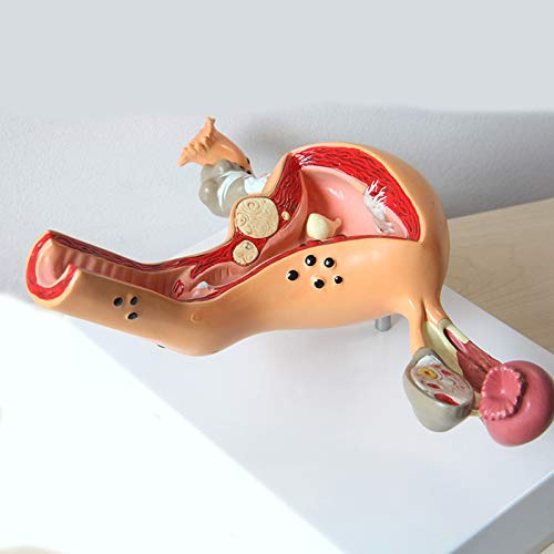 Model Jajnika, Adneksa Macicy, Anatomia Medyczna, Patologia, Materiały Medyczne Nauczające 23x16 Cm/9.06 X 6.30 W