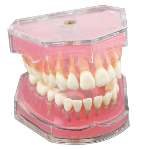 Modèle de dents Typodont de haute précision pour la formation des dentistes