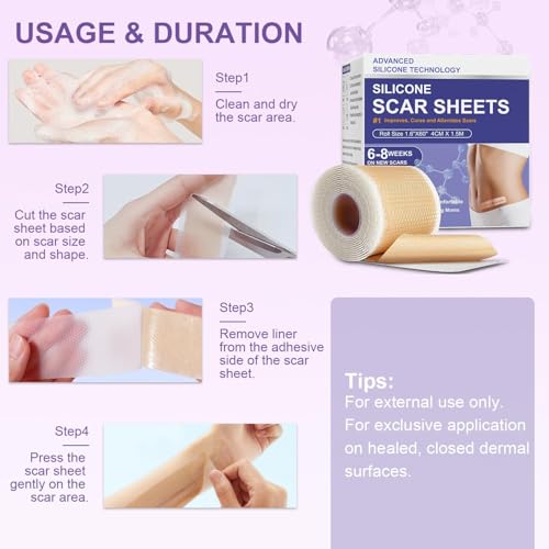Image of Silicone Scar Sheets, Advanced Medical Silicone Scar Tape(1.6 inchx 60 inchRoll-1.5M), Professional Grade Scar Removal Strip for Surgery, Tummy, Mouth, Face, C Section, Burn, Keloid, Acne Scars etc