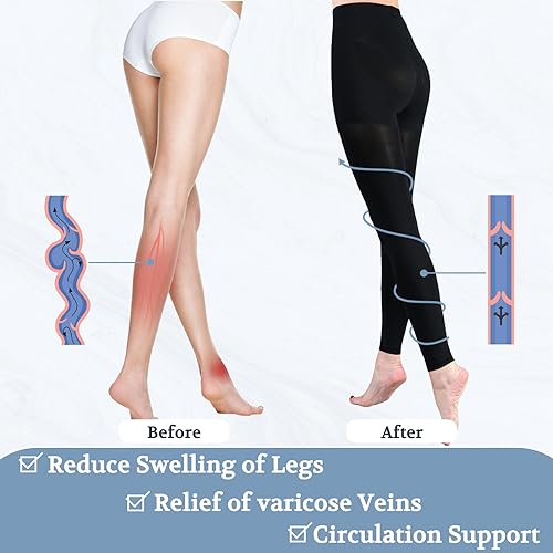 md medical compression pantyhose for women 15-20mmhg graduated compression tights footless leggings for leg support