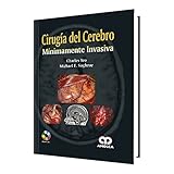  CIRUGIA DEL CEREBRO MINIMAMENTE INVASIVA DVD