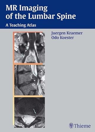 MR-Imaging of the Lumbar Spine: A Teaching Atlas-Wow! eBook