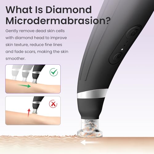 UNOISETION Rechargeable Micro Dermabrasion Tool