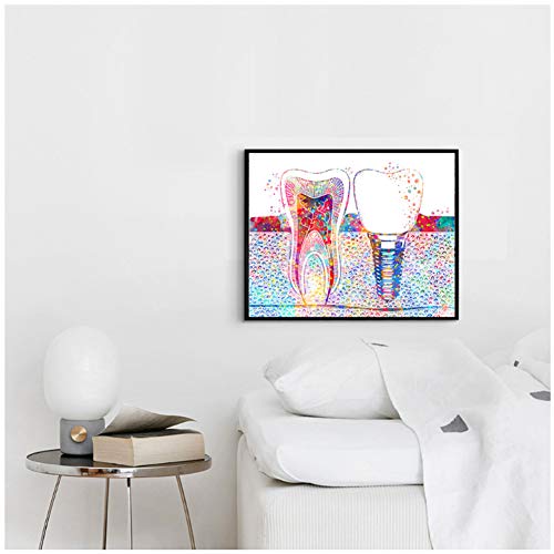 Cuadro de arte dental con implante dental, lienzo para pared, diseño de clínica de dientes, 40 x 60 cm, sin marco