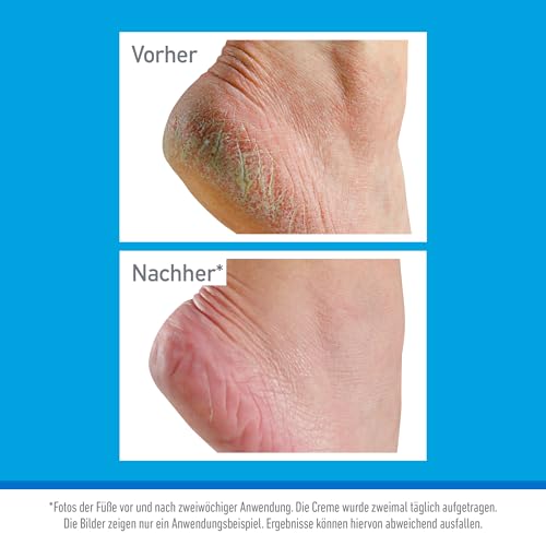 OKeeffes-Healthy-Feet-Fuscreme-Tube-80-ml | Dealmeister.io Alt tag für bilder post titel