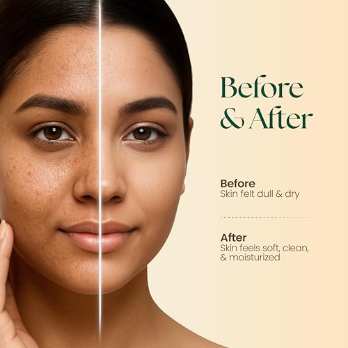 Moha Herbal Face Wash with Neem & Aloe Vera | Herbal Cleanser for Acne and Dark Spots | With Cucumber & Rose Extracts for Glowing Skin | Anti-Pimple & Anti-Acne Face Wash for Women & Men - 100ml - Image 5