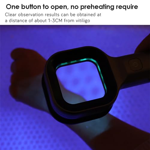 McbeAn Wireless Wood Lamp Skin Analyzer, Portable Facial Salon Beauty Analyzer Lamp Light, One-Key Operation, Observation Clear and Stable, Imported Light Source, for Skin Analysis, Pet Testing