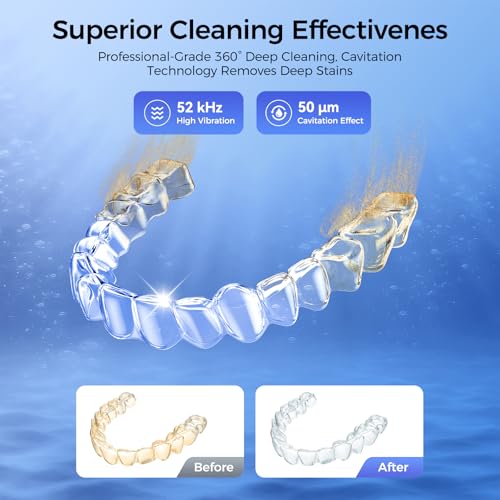 Ultrasonic Cleaner for Retainers