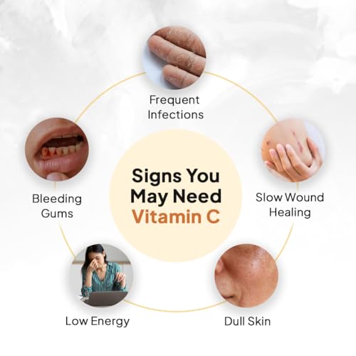 Image of Miduty Liposomal Vitamin C Supplement - Antioxidant Vitamin, Skin Rejuvenation & Immunity Booster Supplement Helps to Boost Collagen for Skin, Hair & Nails - 30 Capsules