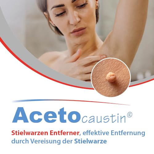 Stielwarzen Entferner Acetocaustin für die effektive Entfernung