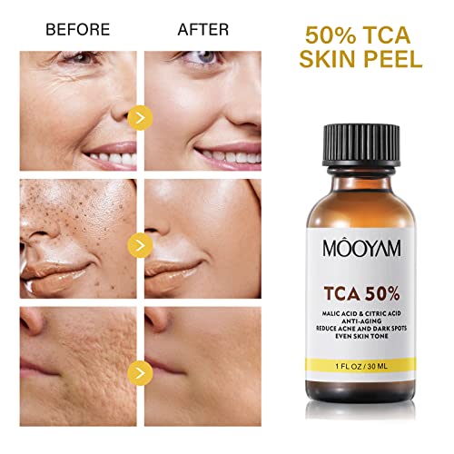 50% Citric Acid Peeling Serum, Professional Chemical Peel For Face, Peeling Solution, Chemical Exfolianting Facial Peel For Dark Skin, Dark Spots, Acne, Wrinkle - 30Ml/1 Fl Oz (50% Citric Acid) #TOP3