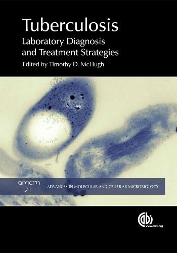 Buy Tuberculosis: Laboratory Diagnosis and Treatment Strategies: 21 (Advances in Molecular and Cellular Microbiology, 21) — BookShops.in